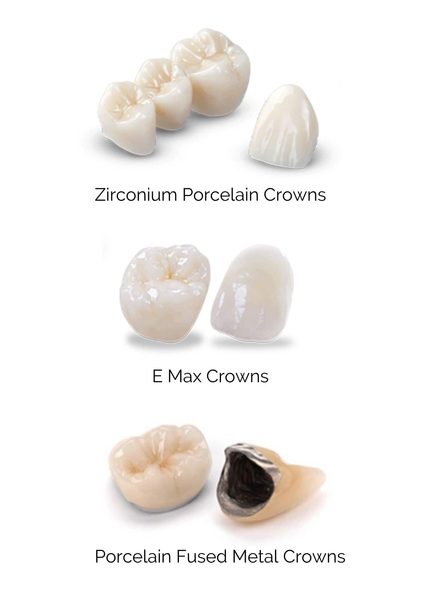 Dental Crown Image 2