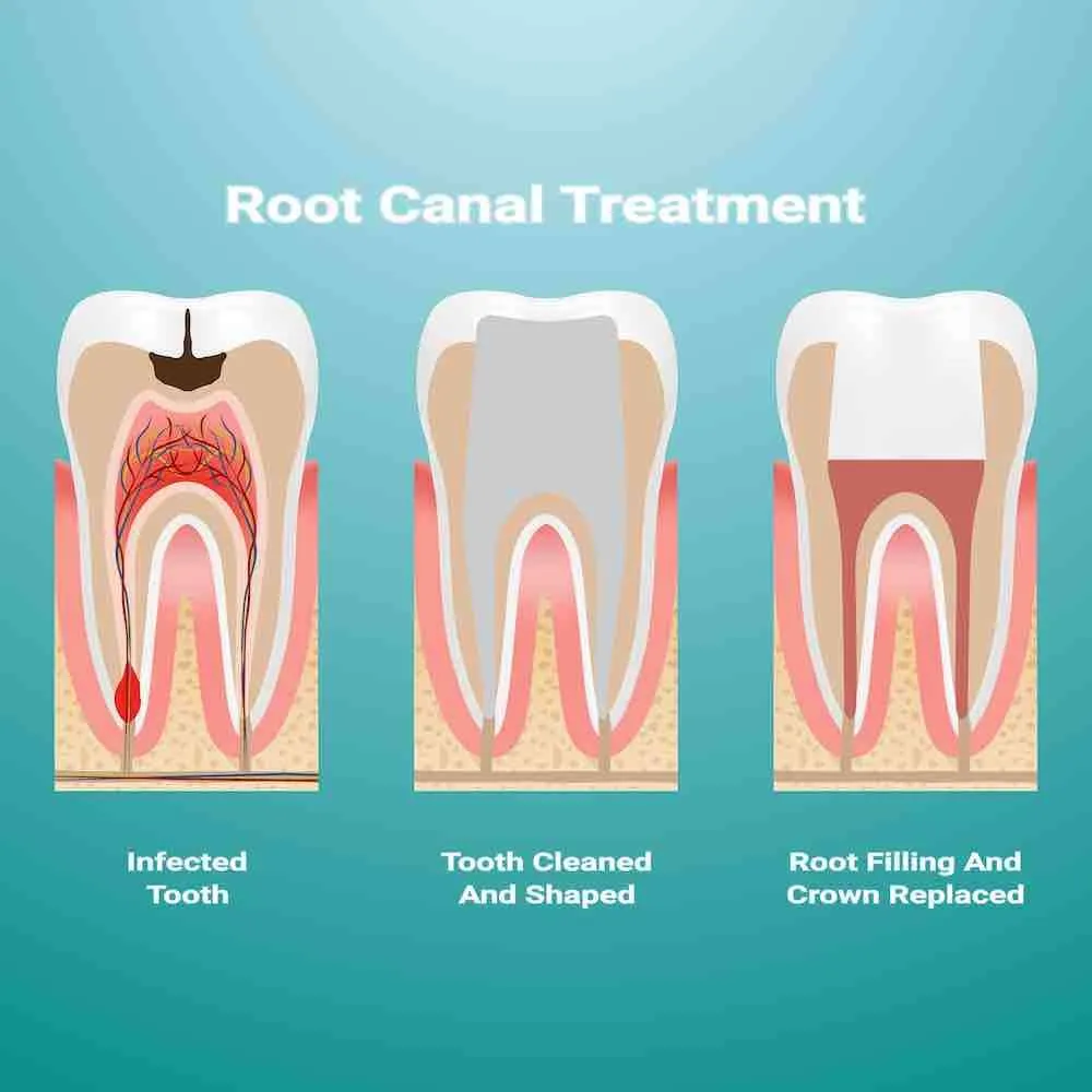 TMJ Therapy Image 1
