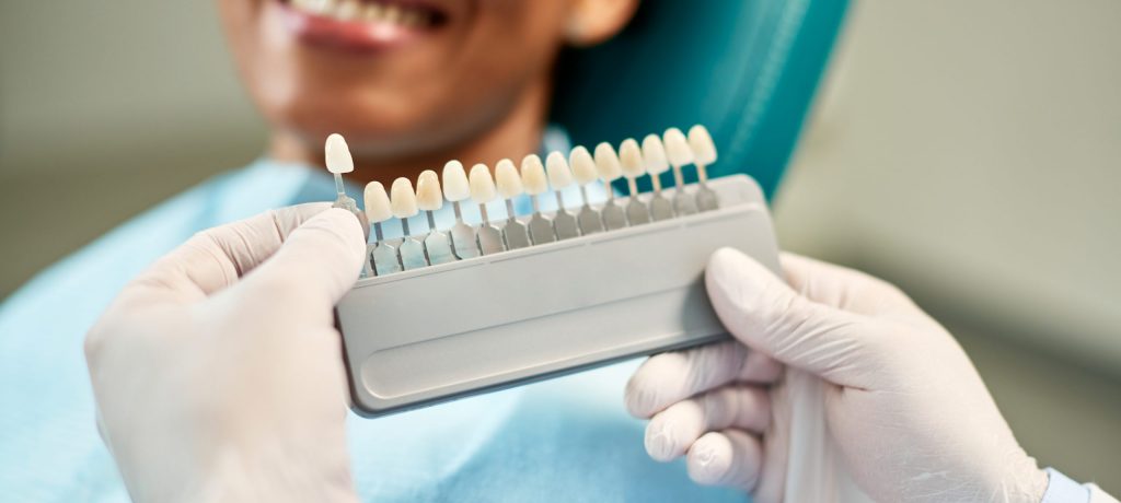 Porcelain Veneers Smile Transformation