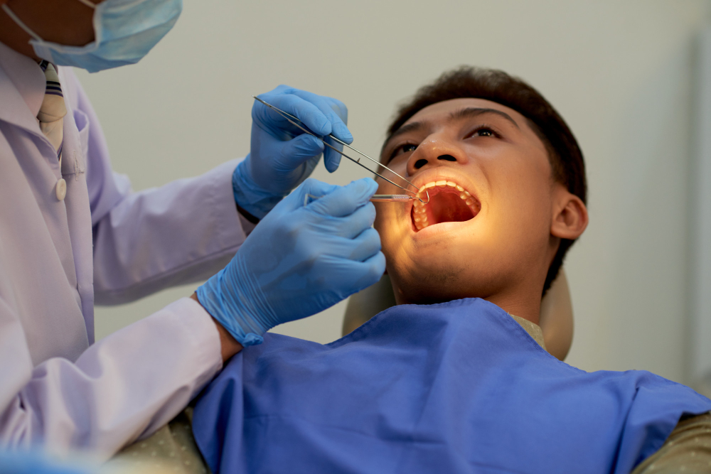 Tooth Extraction